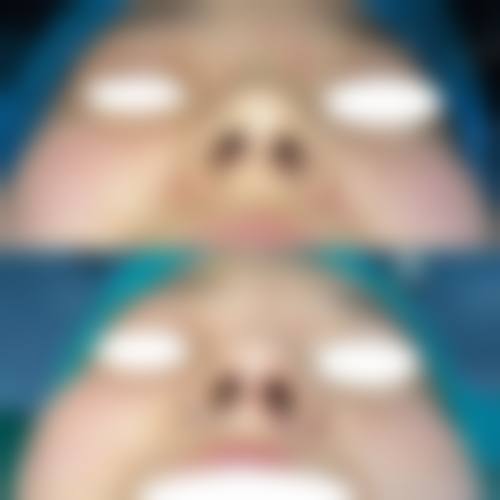 【二、宿迁奕美整形医院擅长诊疗项目有哪些】