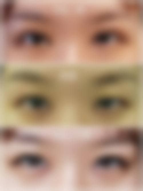 【六、北京宮国华整形医疗美容诊所真实患者口碑评价】