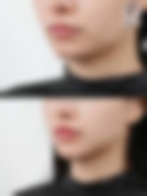 【六、南宁美蒂菲（中科贝拉）医疗美容门诊部真实患者口碑评价】