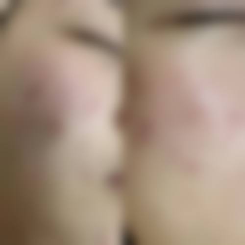 【六、太原黛圣医疗美容诊所真实患者口碑评价】