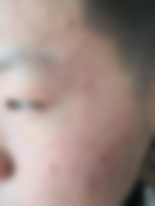 【三、2026 深圳市儿童医院整形美容科项目收费价格参考】