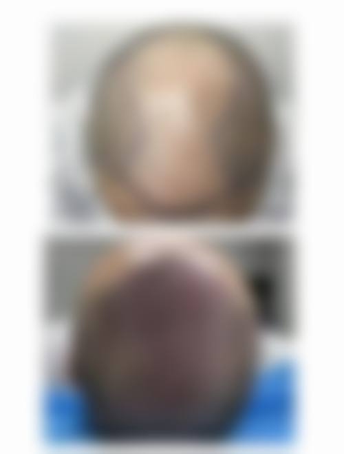 【六、郑州雍禾美度医疗美容诊所真实患者口碑评价】