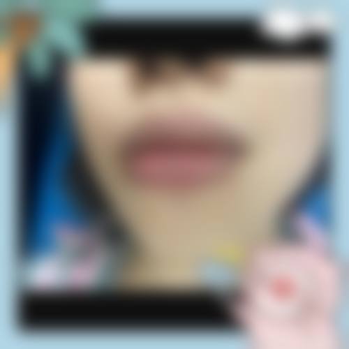 【六、西安爱特蜜医疗美容诊所真实患者口碑评价】