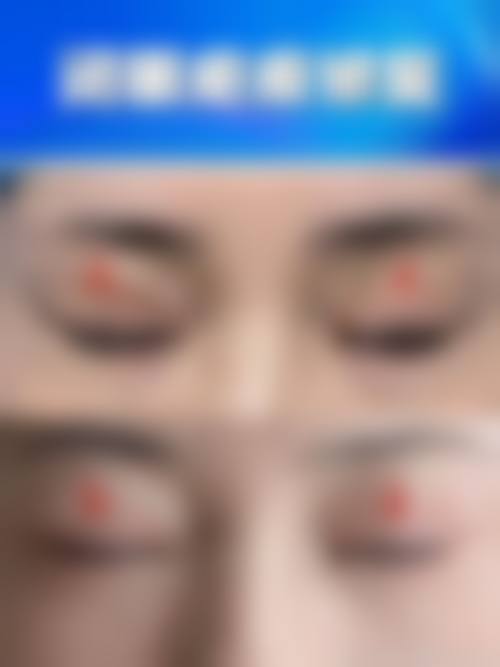 【四、2026 西安爱特蜜医疗美容诊所项目收费价格参考】