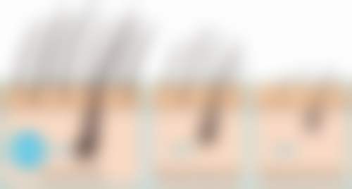 【三、福州碧莲盛植发医院骨干医生团队与技术标准】