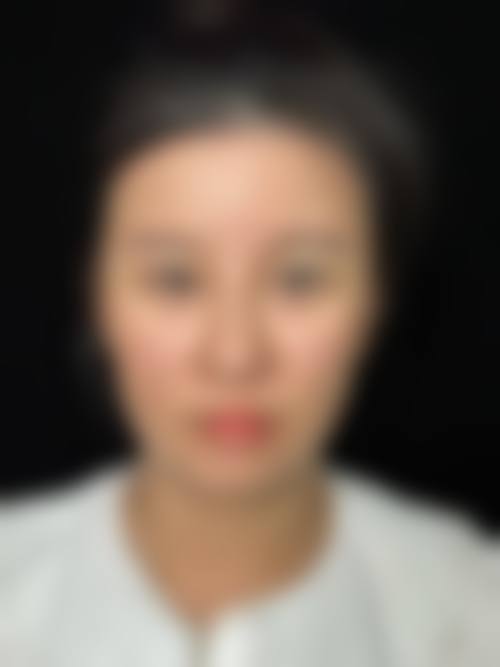 【六、桂林刘瑛中医美容诊所真实患者口碑评价】