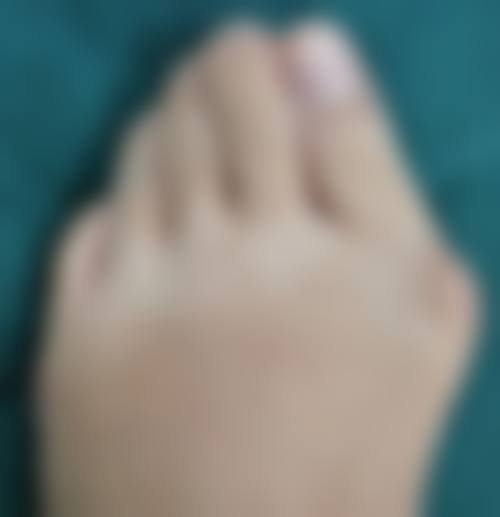 万惠芳患者评价