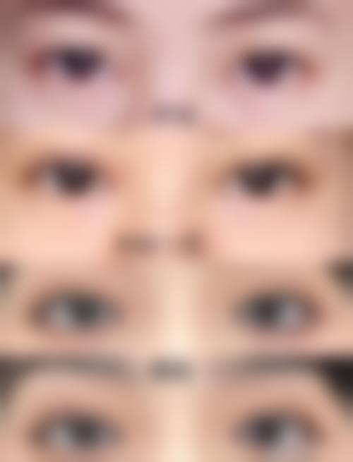 【六、洛阳维亚整形美容医院真实患者口碑评价】