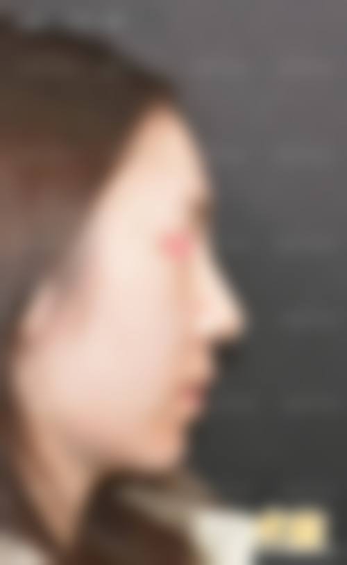 【二、长春秀尔整形医疗美容中 心擅长诊疗项目有哪些】