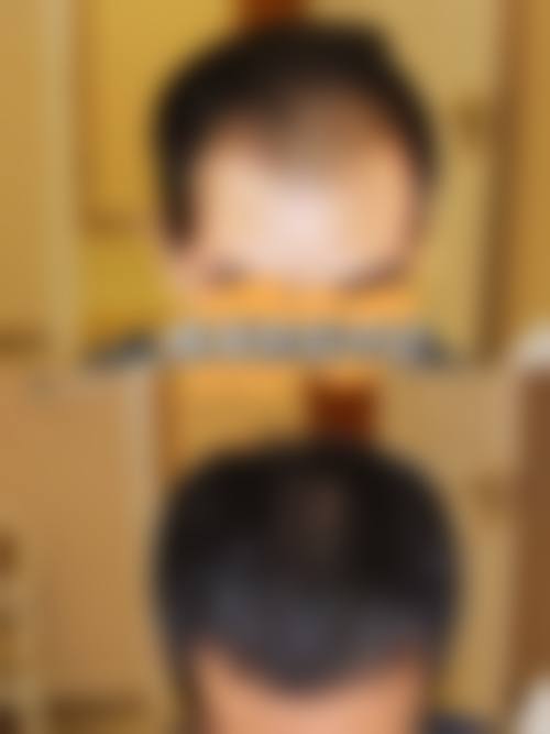 【六、宁波雅太整形医院真实患者口碑评价】