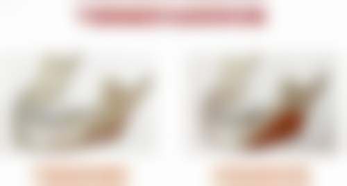 黄青擅长项目列表
