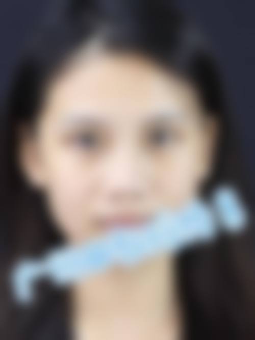 【四、2026 重庆森美整形医院项目收费价格参考】