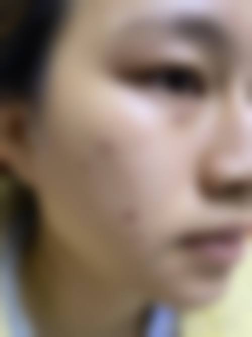 【二、重庆医 科 大学附属儿童医院整形科擅长诊疗项目有哪些】