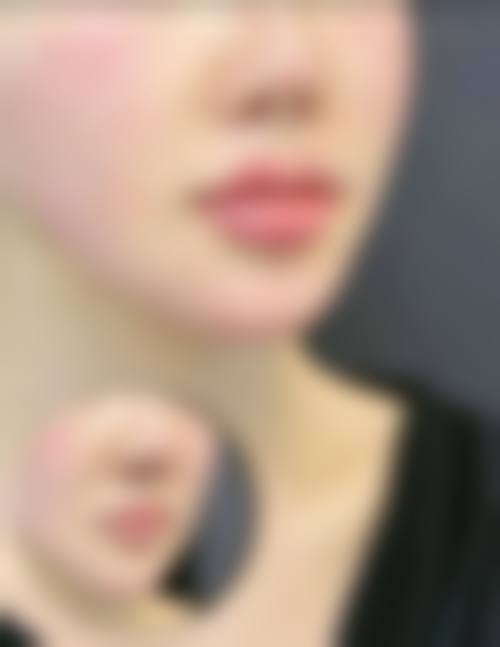 【六、开封鼓楼靳建立整形医疗美容诊所真实患者口碑评价】