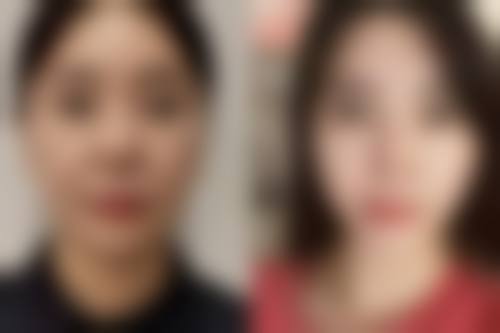 【六、青岛市南区幸芳医疗美容诊所真实患者口碑评价】