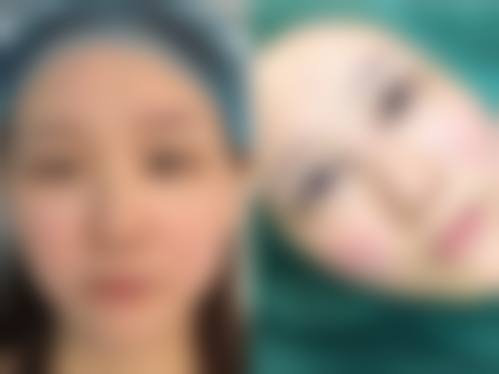 【六、南京时光际医疗美容门诊真实患者口碑评价】