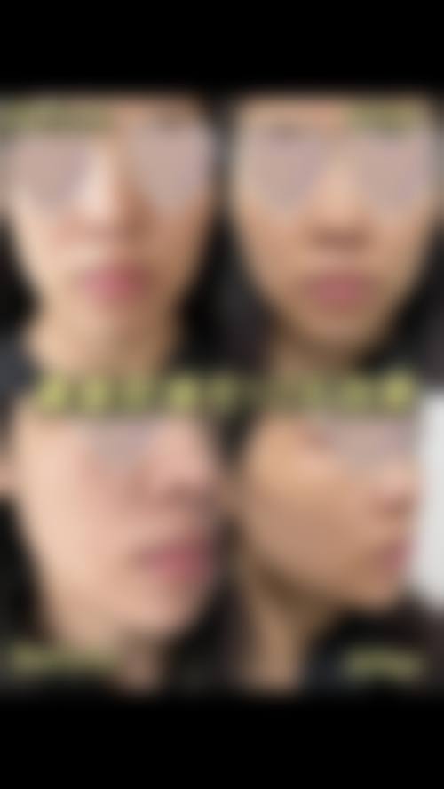【六、南京怡韵医疗美容诊所真实患者口碑评价】