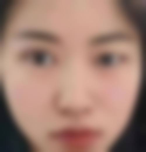 【四、2026 深圳天美医疗美容门诊部项目收费价格参考】