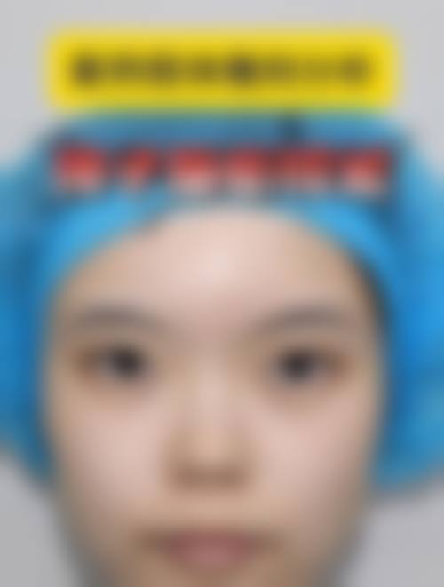 【四、2026 沧州市京美整形医疗美容医院项目收费价格参考】
