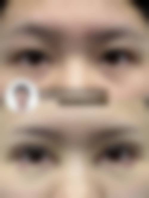 【二、泰国Naravee Clinic美容外科医院擅长诊疗项目有哪些】