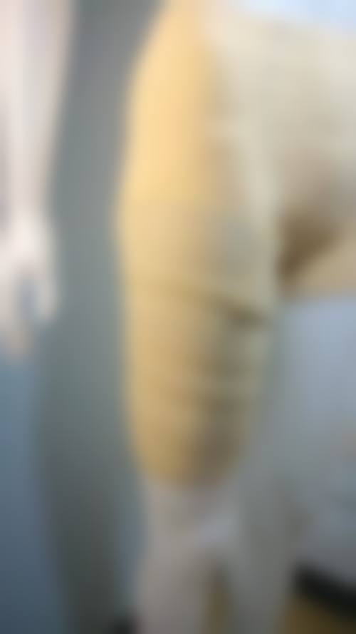 【六、怀化华美整形医院真实患者口碑评价】