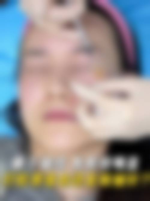 【六、宁乡丽尔维美整形医院真实患者口碑评价】