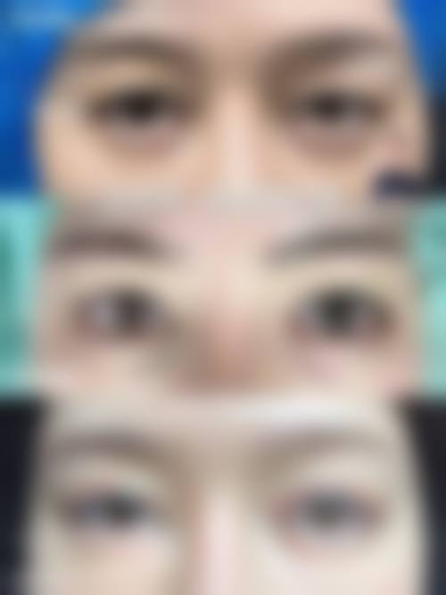 【六、泉州霈云医疗美容门诊部真实患者口碑评价】