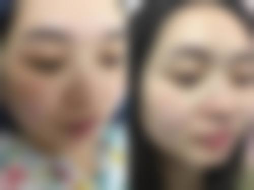 【二、兰州痘你完网络科技有限公司擅长诊疗项目有哪些】