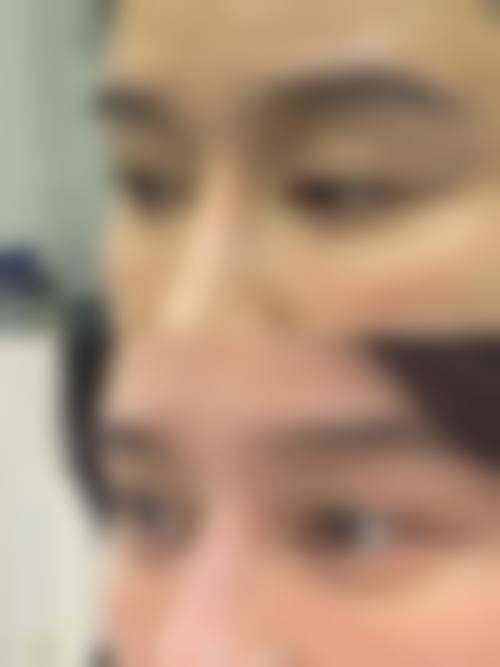 【六、长春熙颜医疗美容门诊部真实患者口碑评价】
