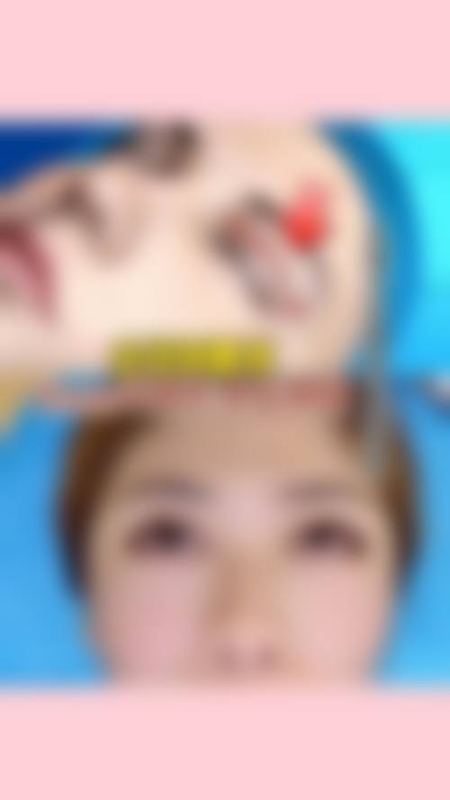 【四、2026 平顶山德美菲整形医院项目收费价格参考】