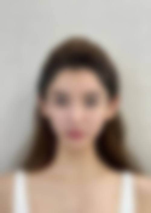 【四、2026 新昌素美医疗美容诊所项目收费价格参考】