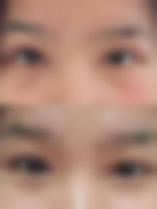 【六、天长恒美整形美容门诊部真实患者口碑评价】