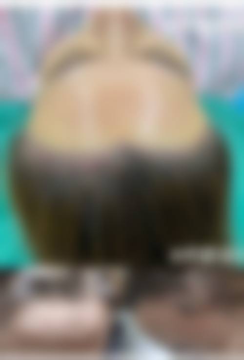 【三、常州百年植发骨干医生团队与技术标准】