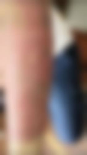 【二、宁波壬美医疗美容医院擅长诊疗项目有哪些】