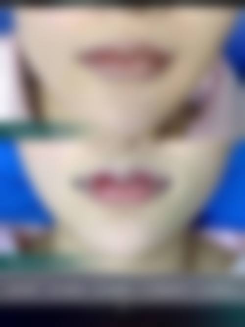 【五、任丘卓芝丽整形医院交通路线指南与预约挂号流程】