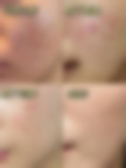 总结