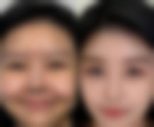 总结