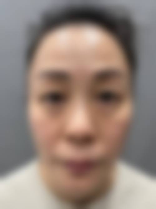 广州美携医疗美容医院怎么预约?