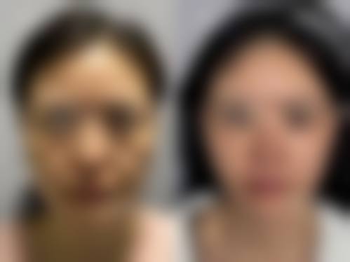 宁德华美整形医院常见问题FAQ