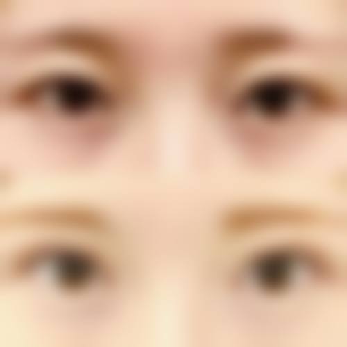 总结