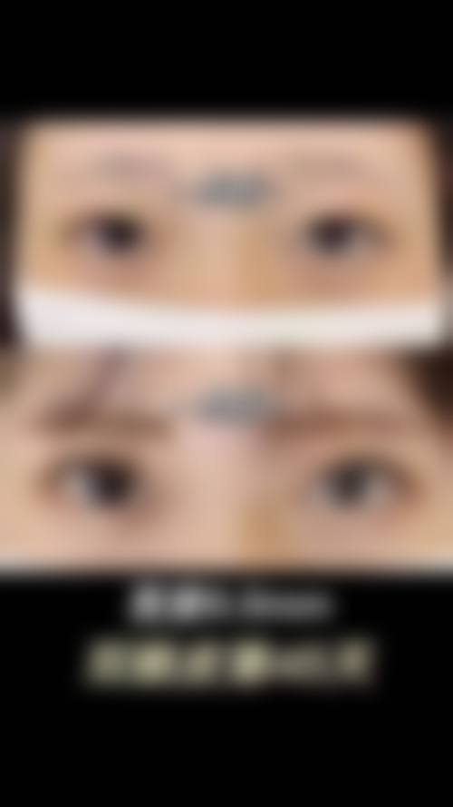 总结