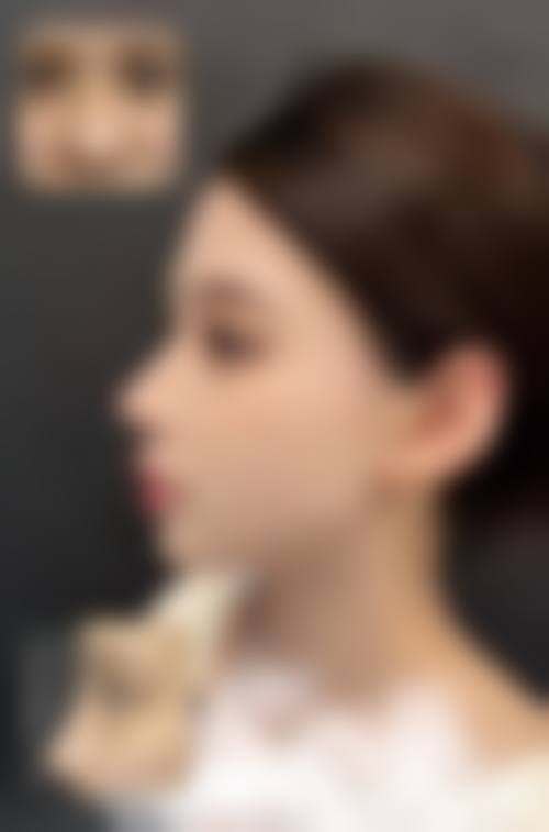 总结