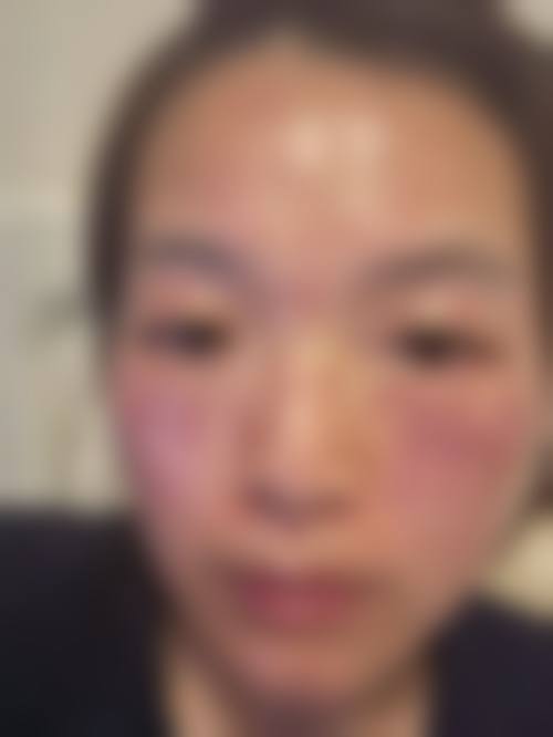 总结