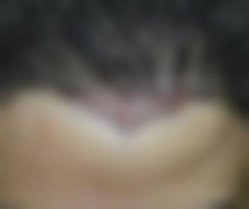 怀化艾美私莉(艾美莉)医疗美容医院常见问题FAQ