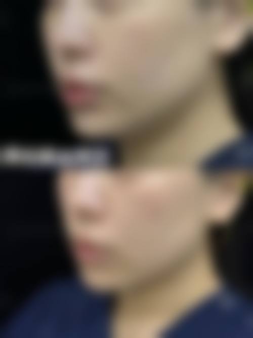 2026库尔勒丁文杰医疗美容诊所价格表(仅供参考)