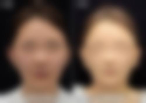 预约方式