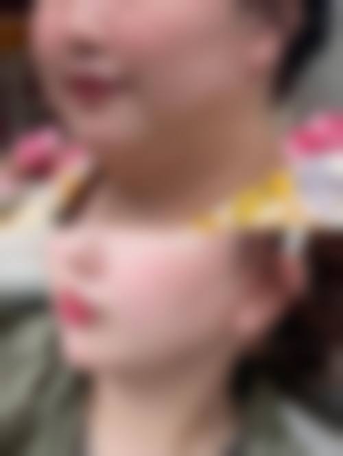 甲府昭和形成外科诊所怎么预约?