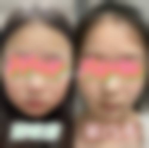 2026甲府昭和形成外科诊所价格表(仅供参考)