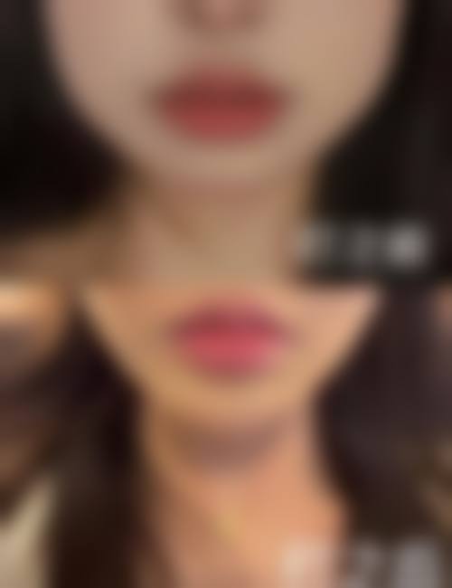 青岛海天医疗美容门诊部怎么预约?