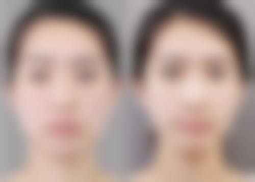 上海圣悯卓俪荟整形医院常见问题FAQ
